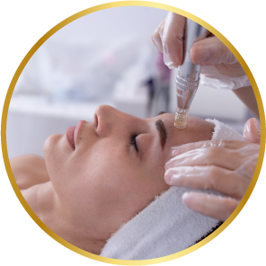 micro-needling